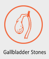 Gallbladder-Stones
