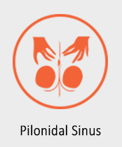 Pilonidal-sinus
